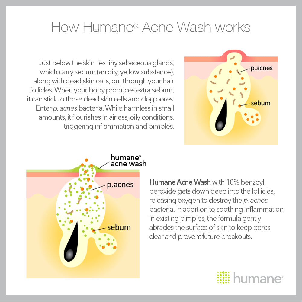 Humane Maximum-Strength 10% Acne Wash